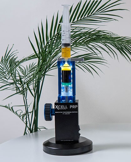 Platelet-Rich Plasma